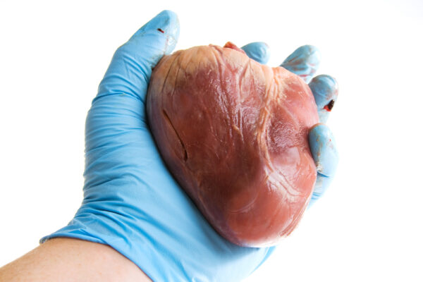 human-heart